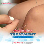 Acupuncture Treatment: Support Your Body's Natural Healing Process